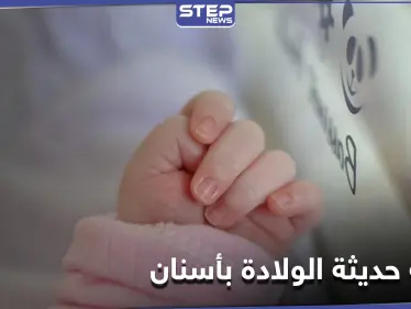 شاهد|| طفلة حديثة الولادة تملك أسناناً.. حالة طبية نادرة في مصر - وكالة ستيب نيوز