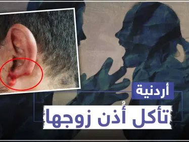 أردنية تأكل أذن زوجها في العاصمة عمّان.. والتفاصيل!! - وكالة ستيب نيوز