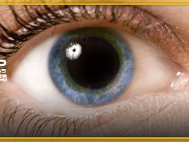 انذار صحي.. علامة صغيرة في العين تدل على نوبة قلبية قريبة - وكالة ستيب نيوز