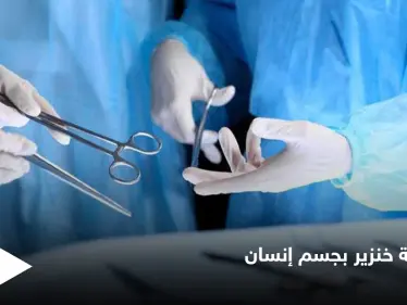 تجارة الأعضاء البشرية إلى زوال بعد نجاح زراعة كلية خنزير في جسم إنسان لأول مرة في التاريخ - وكالة ستيب نيوز