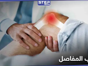 تعرف على أفضل الطرق لعلاج التهاب المفاصل وأسبابه والأعراض الشائعة له - وكالة ستيب نيوز