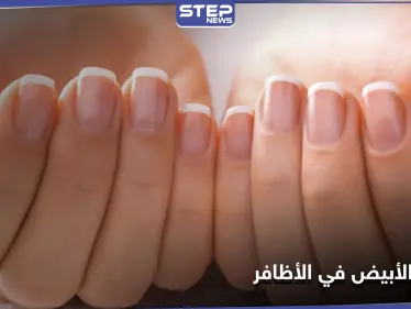 ما سر وجود القوس الأبيض في الأظافر وطريقة التعرف على صحة جسمك من خلاله - وكالة ستيب نيوز