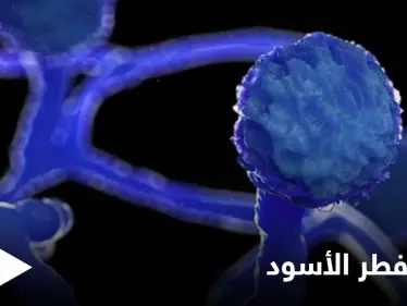 مخاوف من الفطر الأسود.. والصحة العالمية تحذر دولة عربية من وصول المتحور الهندي إليها - وكالة ستيب نيوز