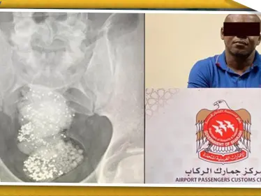 السلطات الإماراتية تلقي القبض على "مهرّب" أخفى الألماس في أحشائه - وكالة ستيب نيوز