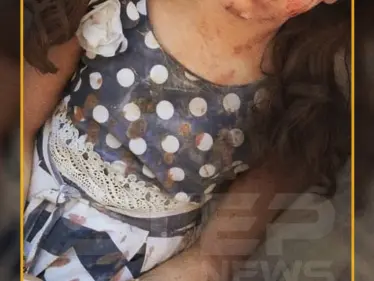 بثوب العيد مصاب وشهيد!! - وكالة ستيب نيوز