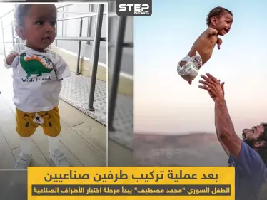 الطفل السوري "محمد مصطيف" بعد عملية تركيب طرفين صناعيين له - وكالة ستيب نيوز