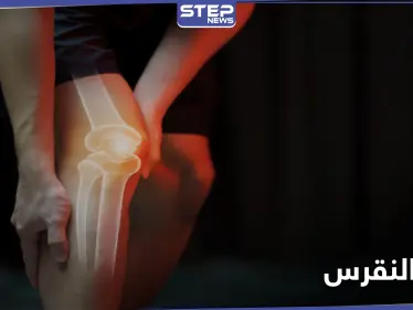 عوامل تزيد من خطر الإصابة بـ داء النقرس - وكالة ستيب نيوز