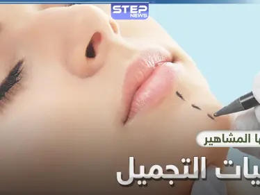 أشهر عمليات التجميل التي يلجأ إليها المشاهير والنجوم - وكالة ستيب نيوز