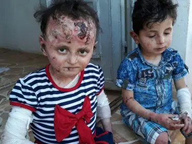 مرض نادر يفتك بطفلين شمالي حلب، ووالدهما يُناشد - وكالة ستيب نيوز