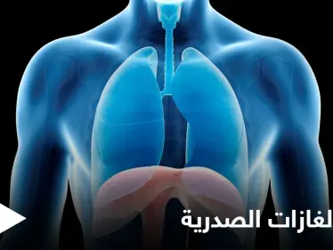 علاج الغازات الصدرية في المنزل وعلاقتها بآلام القلب إليك أهم المعلومات - وكالة ستيب نيوز