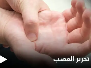 عملية تحرير العصب.. متى يجب إجراؤها وأنواعها إليك أهم المعلومات - وكالة ستيب نيوز