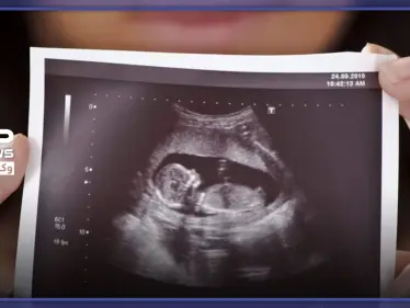 فوائد التصوير رباعي الأبعاد للحامل .. وبعض النصائح الهامة - وكالة ستيب نيوز