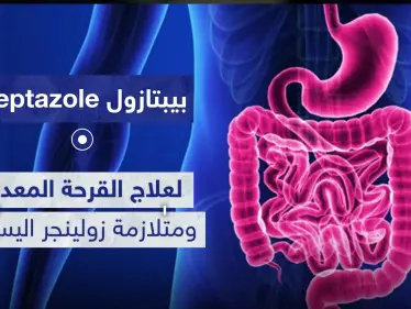 بيبتازول Peptazole لعلاج القرحة المعدية ومتلازمة زولينجر اليسون - وكالة ستيب نيوز