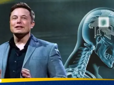 إيلون ماسك يعلن نجاح زراعة أول شريحة بيانات بدماغ بشرية.. ويكشف مهمتها - وكالة ستيب نيوز