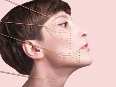 شد الرقبة .. أنواع العملية وكيفية إجراءها ومخاطرها وأسئلة شائعة عنها - وكالة ستيب نيوز