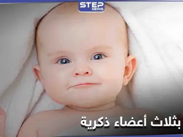 طفل عراقي بـ "3 أعضاء ذكريّة" كأول حالة مُسجلة في العالم - وكالة ستيب نيوز