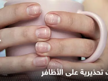 4 علامات تظهر على اليد قد تشير إلى إصابتك بـ مرض السكري لا تتجاهلها - وكالة ستيب نيوز