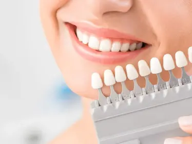 3 طرق منزلية للتخلص صفار الأسنان وطريقة تنظيف الأسنان الصحيحة - وكالة ستيب نيوز