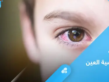 تعرف على علاج حساسية العين عند الاطفال بطرق مختلفة - وكالة ستيب نيوز