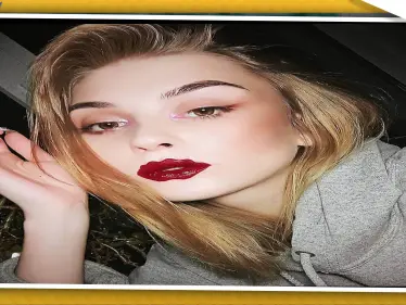 صور || "شفاه الأخطبوط" موضة جديدة في جراحة التجميل للفتيات - وكالة ستيب نيوز