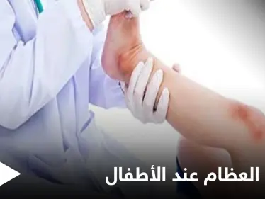 هل تصل الجراثيم إلى العظام وماهي عدوى العظام والمفاصل وخطورتها على الأطفال إليك أهم المعلومات - وكالة ستيب نيوز