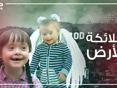 ليسوا منغوليين ..طفرة جينية نتج عنها هذا الشكل ..متلازمة داون الأسباب والتفاصيل - وكالة ستيب نيوز