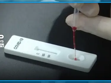 تركيا تطور أسرع وأدق جهاز منزلي للكشف عن "كورونا".. وتضع مقترحًا للقضاء عليه بـ 3 ثواني - وكالة ستيب نيوز