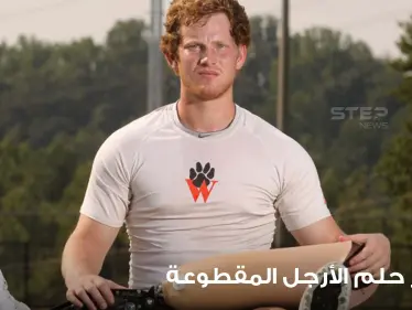 تفسير حلم الأرجل المقطوعة عند أغلب المعبرين ومتى تكون إشارة خير أم شر - وكالة ستيب نيوز