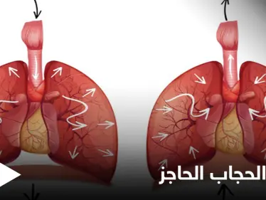 ما هي وظيفة الحجاب الحاجز وكيف يتم علاجه عن طريق العمل الجراحي إليك أهم المعلومات - وكالة ستيب نيوز