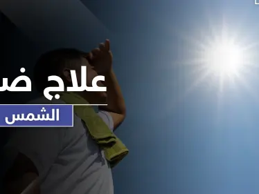ضربة الشمس حالة خطيرة قد تودي بحياة الإنسان .. أسبابها وطرق علاجها - وكالة ستيب نيوز