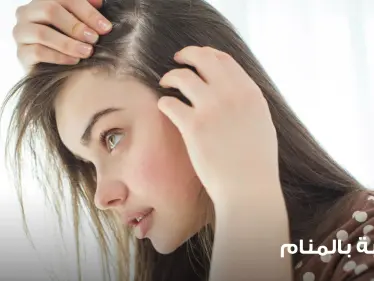 تفسير رؤية الثعلبة في الرأس بالحلم وتفسير سقوط الرموش و الحواجب في المنام - وكالة ستيب نيوز