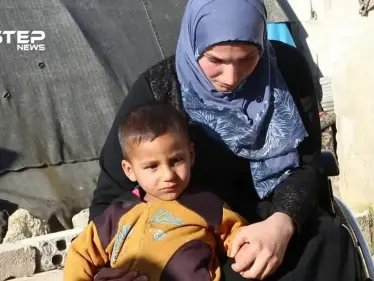 "لم أفقد الأمل رغم إصابتي ومعاناتي وأنا صابرة حتى يفرجها الله" ... صفاء هذه قصتي - وكالة ستيب نيوز