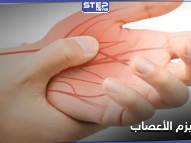 ما هو مرض روماتيزم الأعصاب.. أعراضه الــ"9" وطرق علاجه - وكالة ستيب نيوز