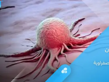 ما هو سرطان القناة الصفراوية وأعراضه الشائعة إليك أهم المعلومات - وكالة ستيب نيوز