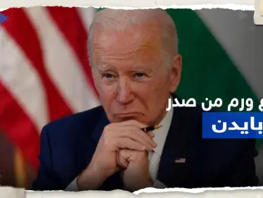 إزالة "ورم جلدي" من صدر بايدن وطبيبه يكشف 3 أمراض يعاني منها - وكالة ستيب نيوز