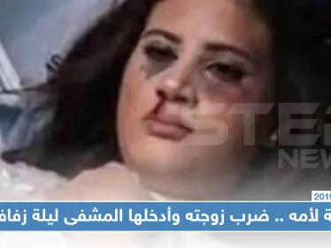 سمع كلام أمه وضرب زوجته ليلة زفافهما فأدخلها إلى العناية المركزة - وكالة ستيب نيوز