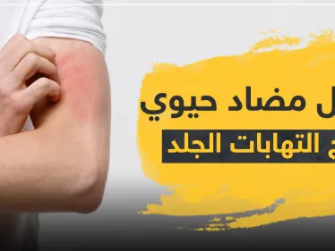 8 أسماء ... أفضل مضاد حيوي لعلاج التهابات الجلد - وكالة ستيب نيوز