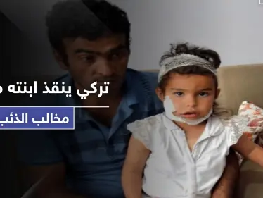 شاهد كيف أنقذ رجل تركي ابنته الصغيرة من بين مخالب ذئب - وكالة ستيب نيوز