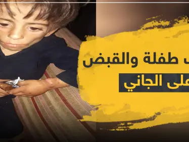 بالصور|| طفلة تتعرض لأبشع أنواع التعذيب على يد والدها والمعارضة السورية تقبض عليه - وكالة ستيب نيوز