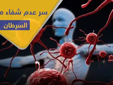 بحث أمريكي حديث.. يكشف خفايا مرض السرطان وسبب عدم امتثال المرضى للشفاء - وكالة ستيب نيوز