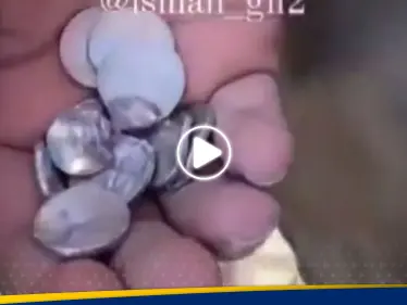 شاهد|| "معجزة" تنقذ حياة رجل فلسطيني من هجوم دوار النابلسي - وكالة ستيب نيوز