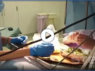 بالفيديو|| في حدث نادر لا يتكرر كثيراً.. سيدة تعد الطعام خلال خضوعها لعملية بالدماغ - وكالة ستيب نيوز