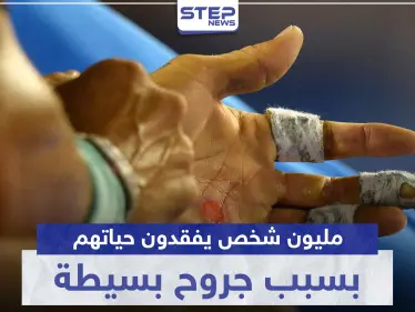 مليون شخص يفقدون حياتهم سنوياً بسبب جروح لا نعطيها أهمية.. تعرف ماذا تقول الدراسات - وكالة ستيب نيوز
