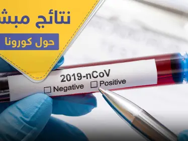 العلماء يتوصلون لنتيجة مبشرة حول كورونا .. والدواء - وكالة ستيب نيوز