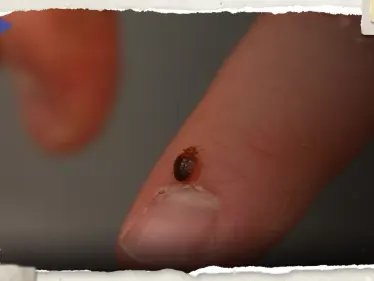 "آفة مزعجة" تنتشر في باريس ومطالب للحكومة الفرنسية بتحرك عاجل - وكالة ستيب نيوز