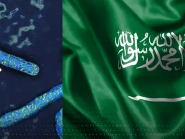 بعد تحذير عُمان.. السعودية توصي مواطنيها بالامتناع عن السفر لدولتين أفريقيتين بسبب فيروس ماربورغ - وكالة ستيب نيوز