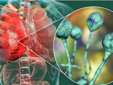 منظمة الصحة العالمية تكشف لـ