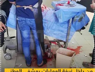 صورة متداولة من داخل غرفة العمليات بمشفى الوطني (النسائي) الملحق بمبنى مشفى الأسد الجامعي بدير الزور - وكالة ستيب نيوز