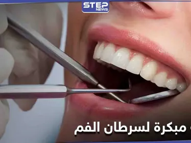 علامة بسيطة على الشفاه غير مبررة قد تكون دليل على الإصابة في سرطان الفم - وكالة ستيب نيوز