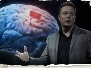 شريحة ماسك تدخل في أدمغتنا رسمياً.. والشركة المسؤولة تكشف الهدف منها - وكالة ستيب نيوز